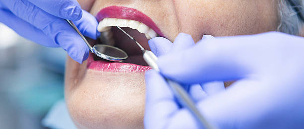 Best Emergency Orthodontic Repairs in Rmichael, CA